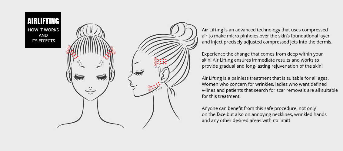 Air Lifting is an advanced technology that uses compressed
					/air to make micro pinholes over the skin's foundational layer
					/and inject precisely adjusted compressed jets into the dermis.