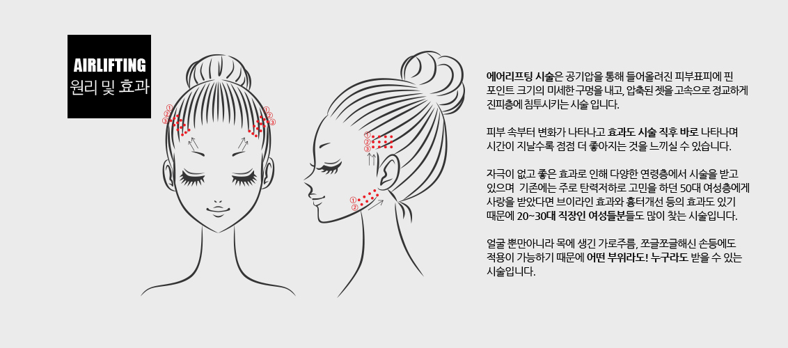 에어리프팅 시술은 공기압을 통해 들어올려진 피부표피에 핀 포인트 크기의 미세한 구멍을 내고, 압축된 젯을 고속으로 정교하게 진피층에 침투시키는 시술 입니다.
				/ 피부 속부터 변화가 나타나고 효과도 시술 직후 바로 나타나며 시간이 지날수록 점점 더 좋아지는 것을 느끼실 수 있습니다.
				/ 자극이 없고 좋은 효과로 인해 다양한 연령층에서 시술을 받고 있으며  기존에는 주로 탄력저하로 고민을 하던 50대 여성층에게 사랑을 받았다면 브이라인 효과와 흉터개선 등의 효과도 있기  때문에 20~30대 직장인 여성들분들도 많이 찾는 시술입니다.
				/ ​얼굴 뿐만아니라 목에 생긴 가로주름, 쪼글쪼글해신 손등에도  적용이 가능하기 때문에 어떤 부위라도! 누구라도 받을 수 있는 시술입니다.